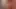 xHamster – Blonde’s Butthole Beet Red From Overuse